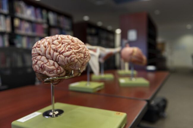 An anatomical model of a brain